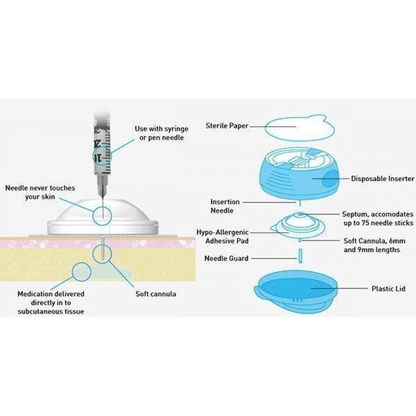 Diagram illustrating i-Port Advance™ features for painless insulin administration and easy insertion.